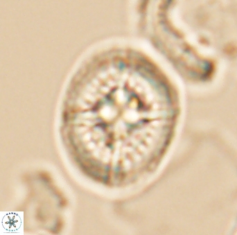 Cretarhabdus conicus 10097