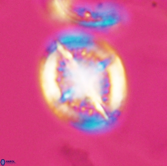 Cretarhabdus conicus 10101