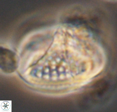 Cretarhabdus conicus 10432