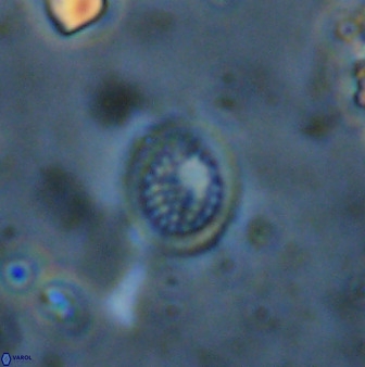 Cretarhabdus circularis 41101