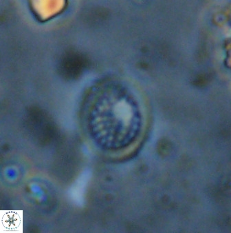 Cretarhabdus circularis 41101