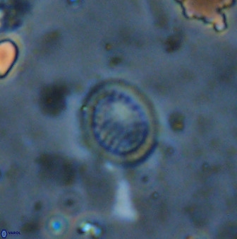 Cretarhabdus circularis 41103