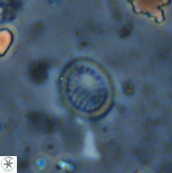 Cretarhabdus circularis 41103