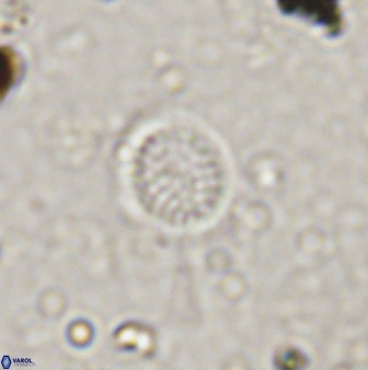 Cretarhabdus circularis 41104