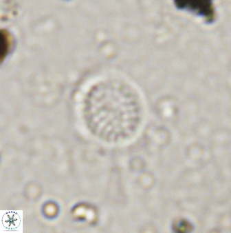 Cretarhabdus circularis 41104