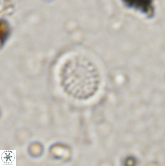 Cretarhabdus circularis 41105