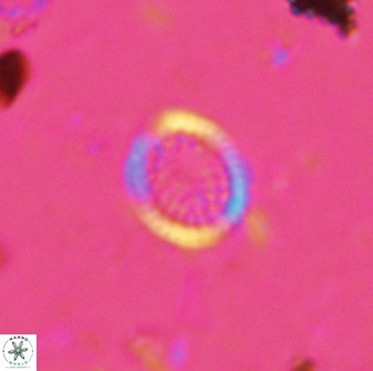 Cretarhabdus circularis 41107