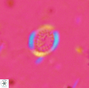 Cretarhabdus circularis 41111