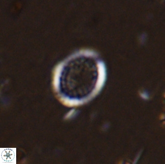 Cretarhabdus circularis 41112