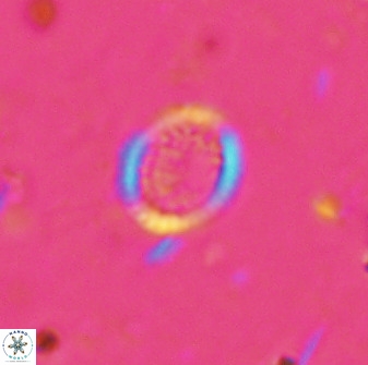 Cretarhabdus circularis 41113