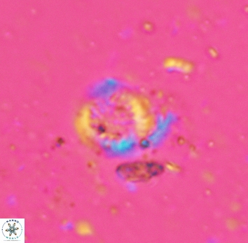 Cretarhabdus circularis 5424