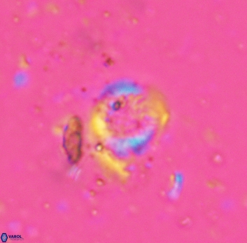 Cretarhabdus circularis 5420