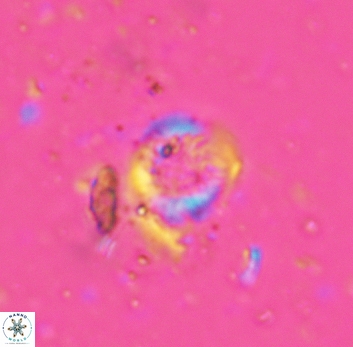 Cretarhabdus circularis 5420