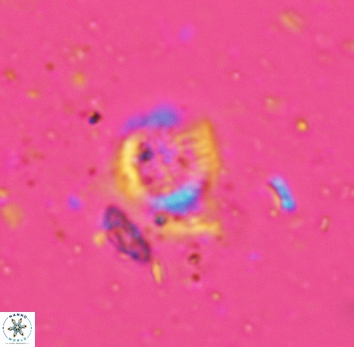 Cretarhabdus circularis 5422