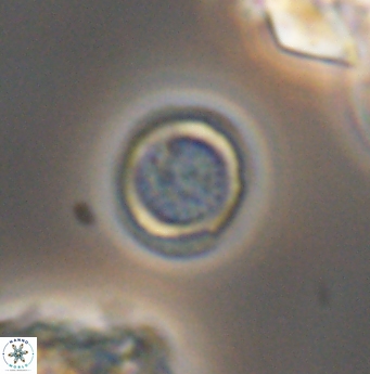 Cretarhabdus circularis 11949