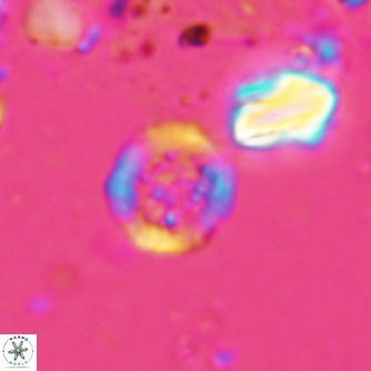 Cretarhabdus circularis 1501