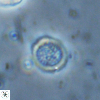 Cretarhabdus circularis 33940