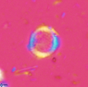 Cretarhabdus circularis 33946