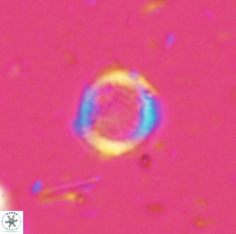 Cretarhabdus circularis 33946