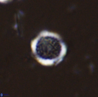 Cretarhabdus circularis 33935