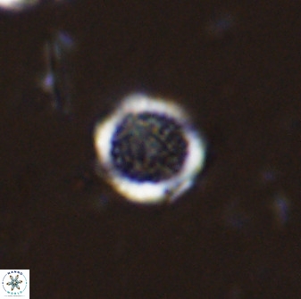 Cretarhabdus circularis 33935