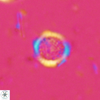 Cretarhabdus circularis 33936