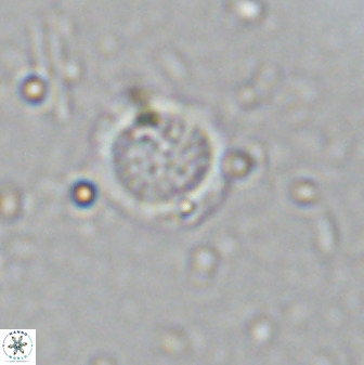 Cretarhabdus circularis 33937