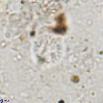 Cretarhabdus circularis 37771