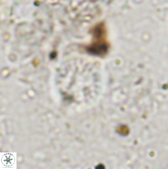Cretarhabdus circularis 37771