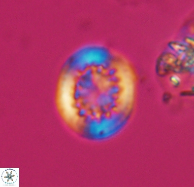 Cretarhabdus barremianus 10636