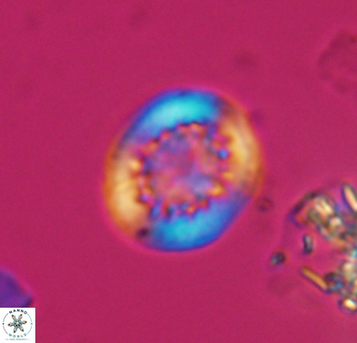 Cretarhabdus barremianus 10638