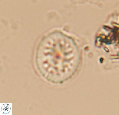 Cretarhabdus barremianus 10639