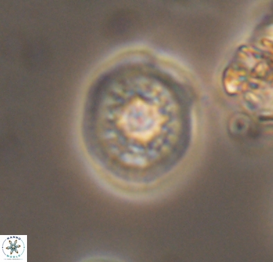 Cretarhabdus barremianus 10640
