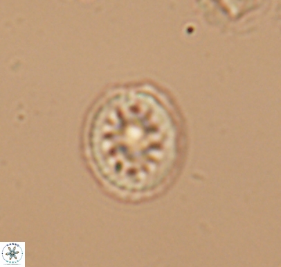 Cretarhabdus barremianus 10744
