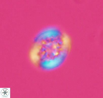Cretarhabdus barremianus 10750