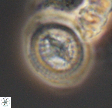 Cretarhabdus limbicrassa 10352