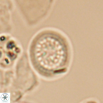 Cretarhabdus primus 12985