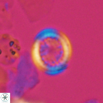 Cretarhabdus primus 12988