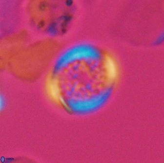 Cretarhabdus primus 12992