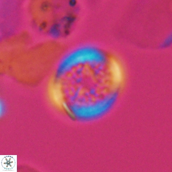 Cretarhabdus primus 12992