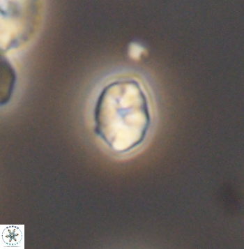 Crepidolithus parvulus 11204