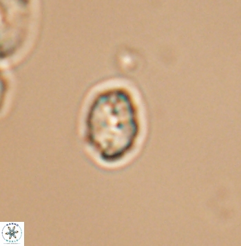 Crepidolithus parvulus 11205