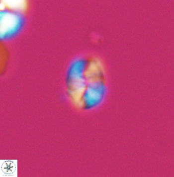 Crepidolithus parvulus 11201