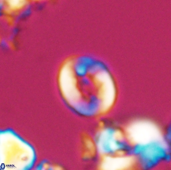 Crepidolithus perforatus 10989