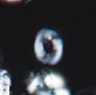 Crepidolithus perforatus 10990