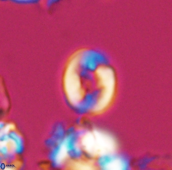 Crepidolithus perforatus 10991