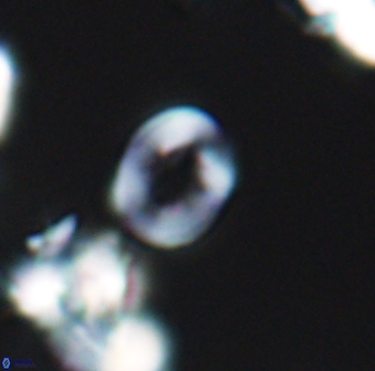 Crepidolithus perforatus 10992