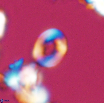 Crepidolithus perforatus 10993