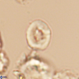 Crepidolithus perforatus 10994