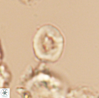 Crepidolithus perforatus 10994